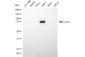 Western blotting analysis using ALPL antibody (ABIN7797577).