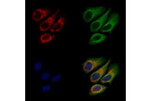 ABIN7094748 and ABIN7098799 staining Hela cells by IF/ICC.