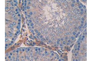Used in DAB staining on fromalin fixed paraffin- embedded stomach tissue (ANGPTL2 Antikörper  (AA 47-207))