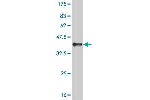 Western Blot detection against Immunogen (35. (RAD1 Antikörper  (AA 1-90))