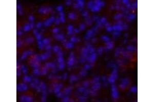 Immunofluorescence analysis of Rat lung tissue using GLUT-1 Polyclonal Antibody at dilution of 1:200. (GLUT1 Antikörper)