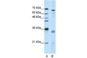 WB Suggested Anti-SFRS1  Antibody Titration: 5. (SRSF1 Antikörper  (Middle Region))