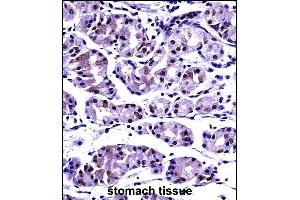 Immunohistochemistry (Paraffin-embedded Sections) (IHC (p)) image for anti-Protein Phosphatase 2, Catalytic Subunit, beta Isozyme (PPP2CB) (AA 278-307), (C-Term) antibody (ABIN657687)