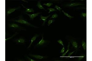 Immunofluorescence of purified MaxPab antibody to GOLGA1 on HeLa cell. (GOLGA1 Antikörper  (AA 1-767))