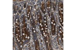 Immunohistochemical staining of human duodenum with KIAA1305 polyclonal antibody  shows strong cytoplasmic and membranous positivity in glandular cells at 1:50-1:200 dilution. (NYNRIN Antikörper)