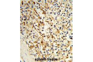 Formalin-fixed and paraffin-embedded human spleen tissue reacted with PCAT1 Antibody (C-term), which was peroxidase-conjugated to the secondary antibody, followed by DAB staining. (LPCAT1 Antikörper  (C-Term))