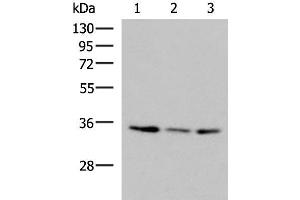 Western blot analysis of HepG2 HL60 cell Human fetal liver tissue lysates using ISY1-RAB43 Polyclonal Antibody at dilution of 1:1000 (ISY1-RAB43 Readthrough (ISY1-RAB43) Antikörper)