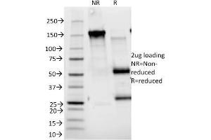 SDS-PAGE Analysis Purified CD25 Mouse Monoclonal Antibody (143-13). (CD25 Antikörper)