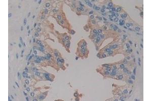 Immunohistochemistry (IHC) image for anti-Hypoxia Inducible Factor 1, alpha Subunit Inhibitor (HIF1AN) (AA 31-349) antibody (ABIN7441979)