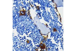 Immunohistochemistry of paraffin-embedded mouse bone marrow using Integrin beta 3 (ITGB3/CD61) (ITGB3/CD61) Rabbit mAb (ABIN7267928) at dilution of 1:100 (40x lens).