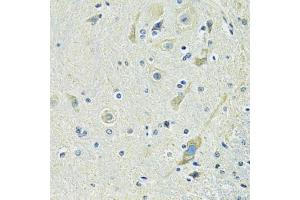 Immunohistochemistry of paraffin-embedded mouse spinal cord using SLC1A4 antibody (ABIN6292419) at dilution of 1:100 (40x lens). (SLC1A4 Antikörper)