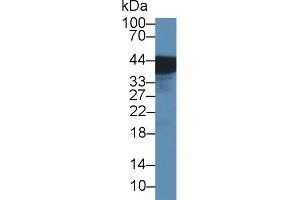 Western Blot; Sample: Rat Bladder lysate; Primary Ab: 1µg/ml Rabbit Anti-Rat UPK3A Antibody Second Ab: 0. (Uroplakin 3A Antikörper  (AA 15-212))
