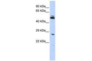 Image no. 1 for anti-Ring Finger Protein 212 (RNF212) (AA 72-121) antibody (ABIN6740828)