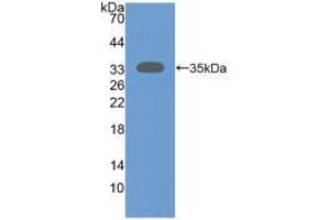 Western blot analysis of recombinant Human SIRT2. (SIRT2 Antikörper  (AA 65-340))
