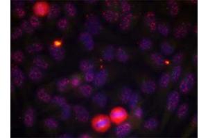 Immunofluorescence staining of methanol-fixed HeLa cells using ELK1 (phospho T417) polyclonal antibody . (ELK1 Antikörper  (pThr417))