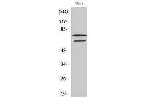 Western Blotting (WB) image for anti-Lamin A/C (LMNA) (Ser78) antibody (ABIN3185344)