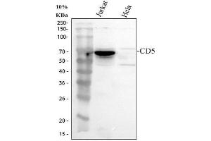 Western blot analysis of CD5 using anti-CD5 antibody (ABIN5693203).