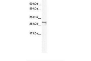 Image no. 1 for anti-Short Stature Homeobox 2 (SHOX2) (AA 180-229) antibody (ABIN6735956) (SHOX2 Antikörper  (AA 180-229))