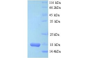 SDS-PAGE (SDS) image for D-Dopachrome Tautomerase (DDT) (AA 2-118) protein (His tag) (ABIN5713400)