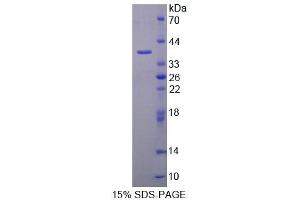 SDS-PAGE analysis of Mouse AADAT Protein. (AADAT Protein)