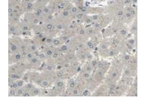 Immunohistochemistry (IHC) image for anti-Microtubule Associated Tumor Suppressor 1 (MTUS1) (AA 1018-1270) antibody (ABIN7444805)