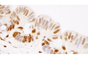 Immunohistochemistry (IHC) image for anti-General Transcription Factor III (GTF2I) (AA 985-998) antibody (ABIN7448971) (GTF2I Antikörper  (AA 985-998))