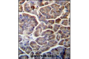 SNX29 Antibody (C-term) (ABIN657262 and ABIN2846357) immunohistochemistry analysis in formalin fixed and paraffin embedded human pancreas tissue followed by peroxidase conjugation of the secondary antibody and DAB staining. (SNX29 Antikörper  (C-Term))