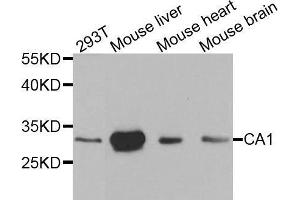 Western blot analysis of extracts of various cell lines, using CA1 antibody. (CA1 Antikörper  (AA 1-261))