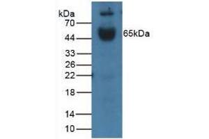 Western blot analysis of Mouse Placenta Tissue. (IL1R1 Antikörper  (AA 20-338))