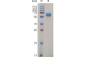 SDS-PAGE (SDS) image for Discoidin Domain Receptor tyrosine Kinase 1 (DDR1) (AA 21-416) protein (His tag) (ABIN7490711)
