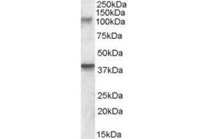 Western Blotting (WB) image for anti-Glutamate Receptor, Ionotropic, Kainate 3 (GRIK3) (AA 203-216) antibody (ABIN343069) (GRIK3 Antikörper  (AA 203-216))