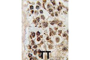 Formalin-fixed and paraffin-embedded human testis tissue reacted with MLLT10 polyclonal antibody  , which was peroxidase-conjugated to the secondary antibody, followed by DAB staining.