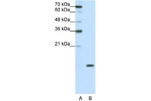 WB Suggested Anti-SNRPD1 Antibody Titration:  0. (SNRPD1 Antikörper  (N-Term))