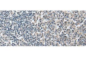 Immunohistochemistry of paraffin-embedded Human tonsil tissue using PLA2G16 Polyclonal Antibody at dilution of 1:40(x200) (PLA2G16 Antikörper)