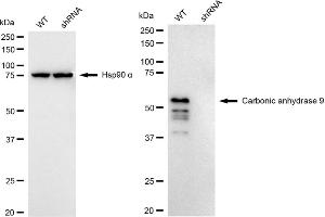 Western blotting analysis using Carbonic anhydrase 9 antibody (ABIN7797869). (Rekombinanter CA9 Antikörper)
