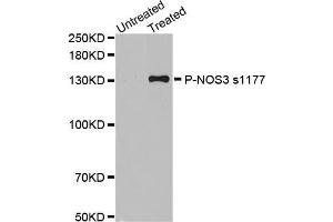 Western blot analysis of extracts of various cell lines, using Phospho-NOS3-S1177 antibody.
