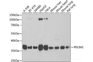 Western blot analysis of extracts of various cell lines using PDLIM1 Polyclonal Antibody at dilution of 1:1000. (PDLIM1 Antikörper)