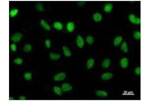 Immunostaining analysis in HeLa cells. (HEXIM1 Antikörper)
