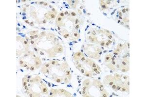 Immunohistochemistry (Paraffin-embedded Sections) (IHC (p)) image for anti-THO Complex 1 (THOC1) antibody (ABIN7264235)