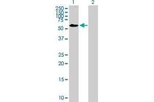 Western Blot analysis of FRMD8 expression in transfected 293T cell line by FRMD8 MaxPab polyclonal antibody. (FRMD8 Antikörper  (AA 1-464))