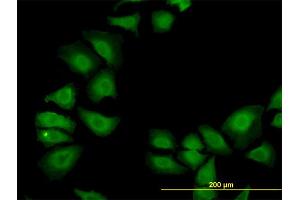 Immunofluorescence of monoclonal antibody to TXN on HeLa cell. (TXN Antikörper  (AA 1-105))