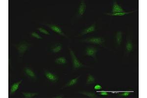 Immunofluorescence of purified MaxPab antibody to CCDC6 on HeLa cell. (CCDC6 Antikörper  (AA 1-474))