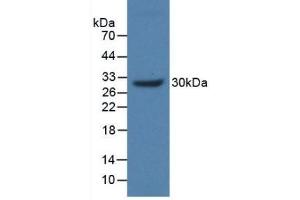 Detection of Recombinant MUC17, Human using Polyclonal Antibody to Mucin 17 (MUC17) (MUC17 Antikörper  (AA 3773-3998))