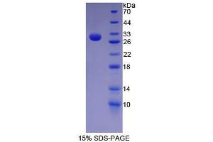 SDS-PAGE analysis of Human Nestin Protein. (Nestin Protein (NES))