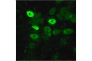 Image no. 1 for anti-Influenza Nucleoprotein antibody (Influenza A Virus) (AA 428-441) (ABIN200003) (Influenza Nucleoprotein Antikörper (Influenza A Virus) (AA 428-441))