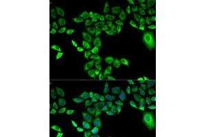 Immunofluorescence analysis of A-549 cells using FMO3 Polyclonal Antibody (FMO3 Antikörper)