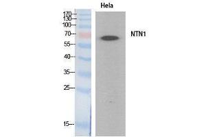 Western Blotting (WB) image for anti-Netrin 1 (NTN1) (Internal Region) antibody (ABIN3178538) (Netrin 1 Antikörper  (Internal Region))