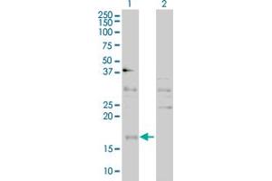 Western Blot analysis of CEBPG expression in transfected 293T cell line by CEBPG polyclonal antibody (A01). (CEBPG Antikörper  (AA 1-150))