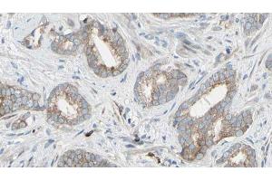 ABIN6268954 at 1/100 staining Human prostate tissue by IHC-P. (EIF4B Antikörper  (Internal Region))