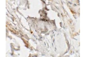 Immunohistochemistry (IHC) image for anti-Hedgehog Acyltransferase-Like (HHATL) (N-Term) antibody (ABIN1031403)